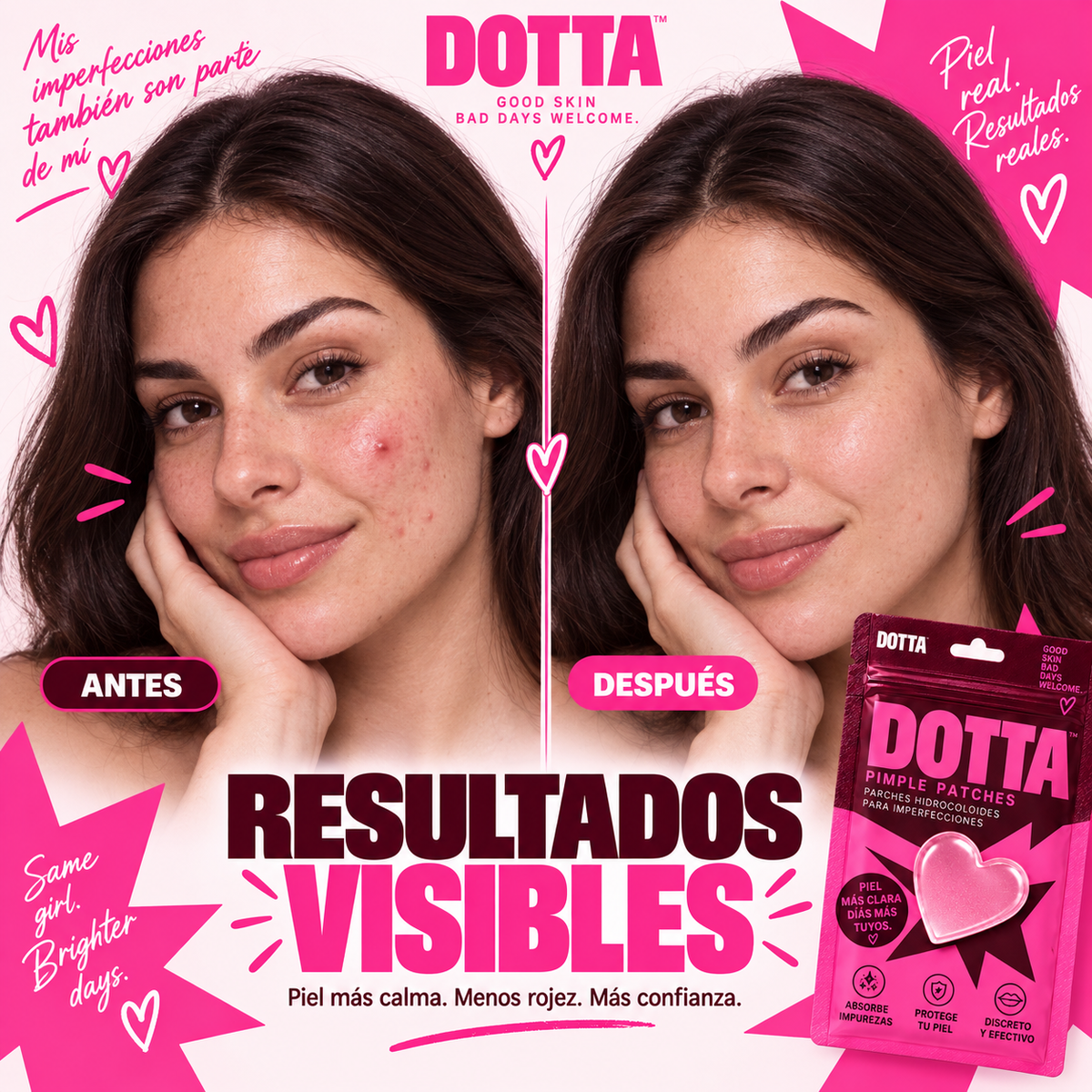 DOTTA™ Hearts Parches Anti-Granitos